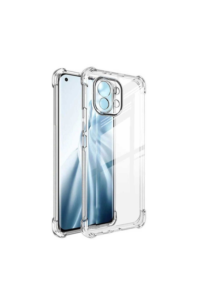 Xiaomi Mi 11 Lite Uyumlu Kılıf Zore Kamera Korumalı Nitro Anti Shock Silikon