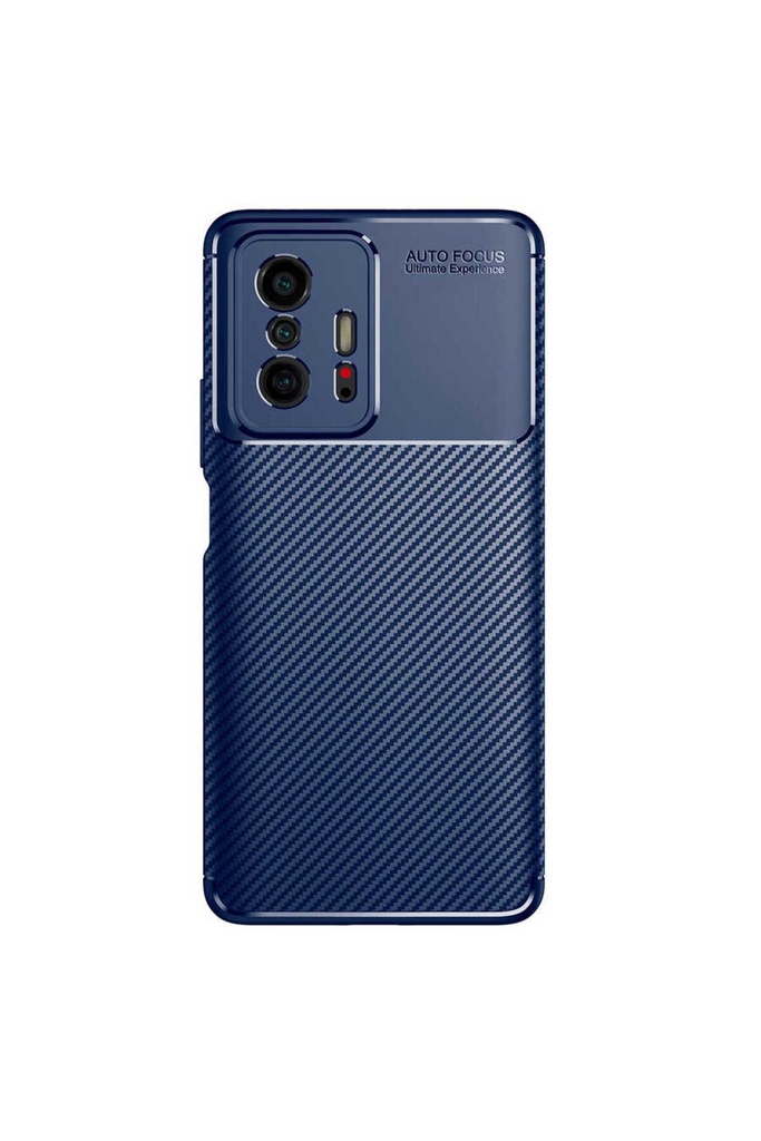 Xiaomi Mi 11T Pro 5G Uyumlu Kılıf Zore Negro Silikon Kapak